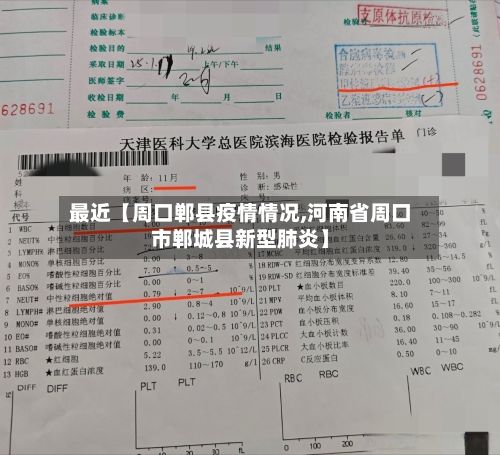 最近【周口郸县疫情情况,河南省周口市郸城县新型肺炎】-第2张图片