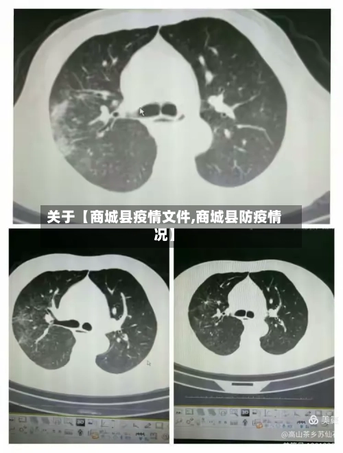 关于【商城县疫情文件,商城县防疫情况】