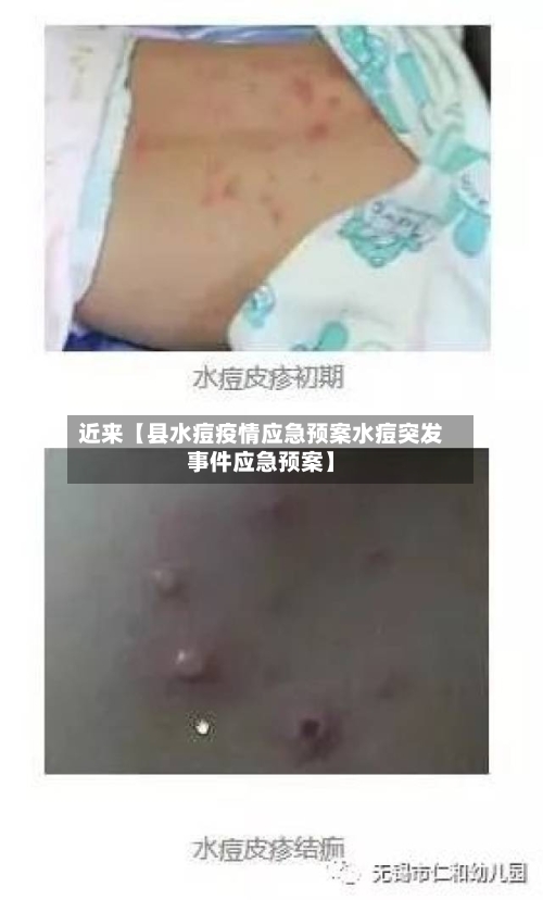 近来【县水痘疫情应急预案水痘突发事件应急预案】