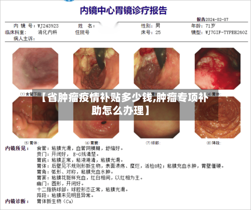 【省肿瘤疫情补贴多少钱,肿瘤专项补助怎么办理】